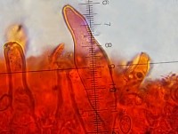 /album/fotogaleria-inocybe-sp-2/cheilocystidy-1-jpg1/